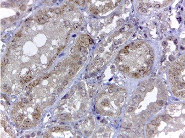 Renalase (aa 224 to 233) Antibody
