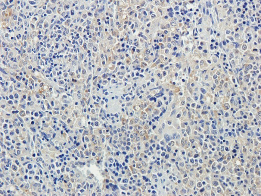 ROCK2 Rabbit Polyclonal Antibody