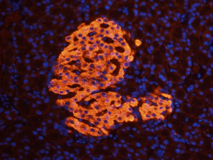 ROR gamma T Rabbit Polyclonal Antibody
