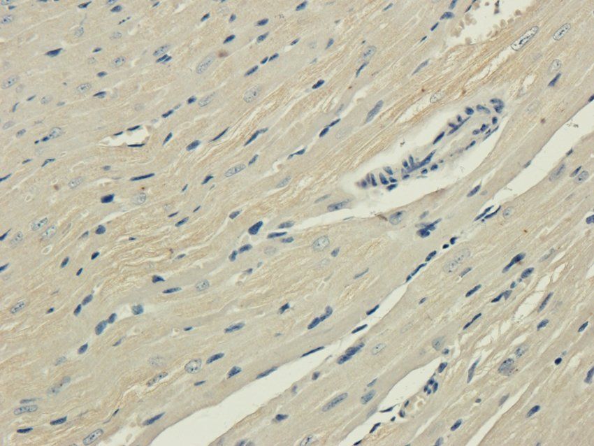 ROR gamma T Rabbit Polyclonal Antibody