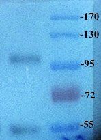 ROR2 Rabbit Polyclonal Antibody