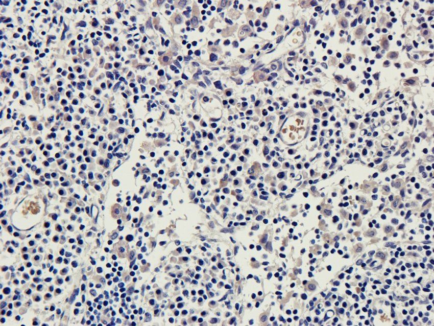 ROS1 Rabbit Polyclonal Antibody