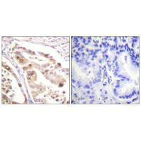 RPA2 Antibody
