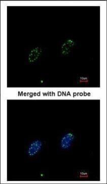 RPA70 Rabbit Polyclonal Antibody