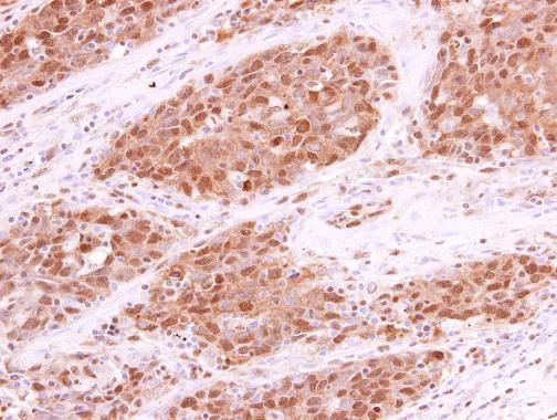 RPA70 Rabbit Polyclonal Antibody