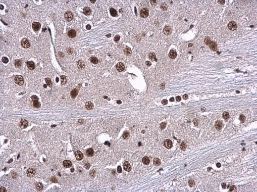 RPA70 Rabbit Polyclonal Antibody