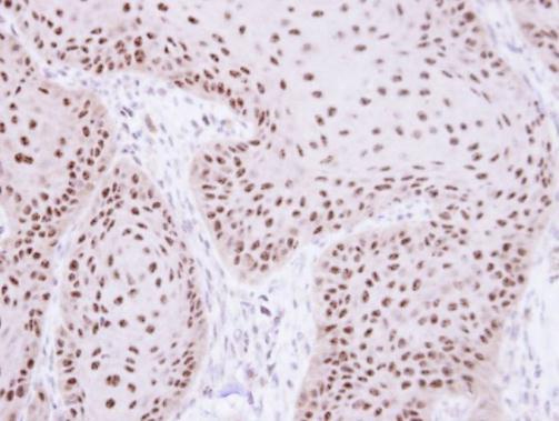 RPA70 Rabbit Polyclonal Antibody