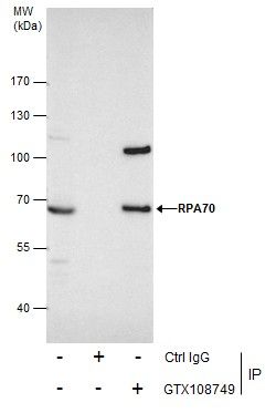 RPA70 Rabbit Polyclonal Antibody