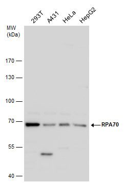 RPA70 Rabbit Polyclonal Antibody