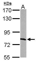 RPA70 Rabbit Polyclonal Antibody