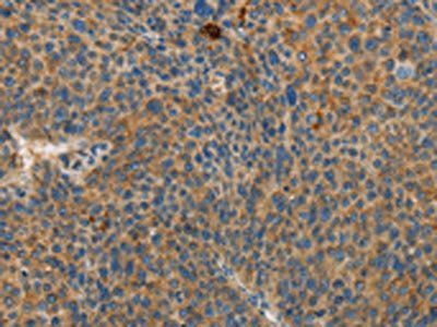 RPS27 Antibody