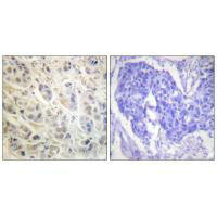 RPS6KA1 Antibody