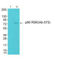 RPS6KA1 Antibody