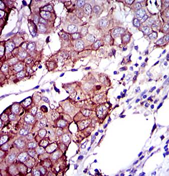 RPS6KB1 Antibody