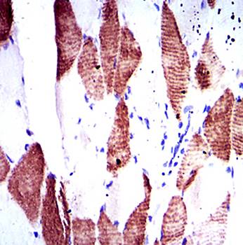 RPS6KB1 Antibody