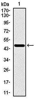 RPS6KB1 Antibody