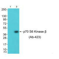 RPS6KB2 Antibody
