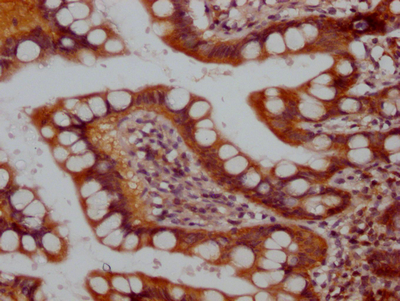 RPTOR Antibody