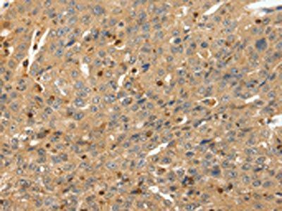 RRAD Antibody
