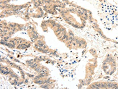 RRAD Antibody