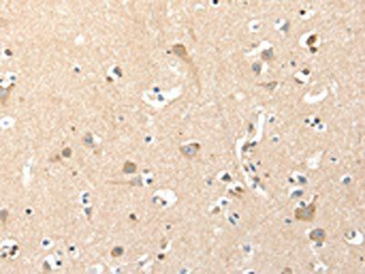RRAD Antibody