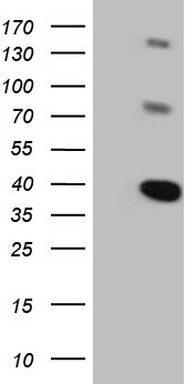 RSPO1 Antibody