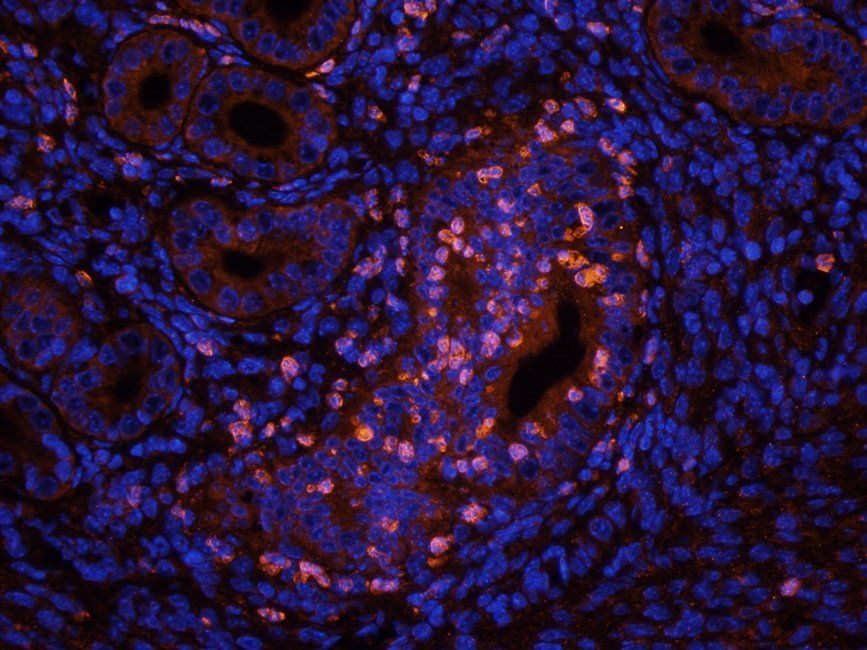 RYR2 Rabbit Polyclonal Antibody