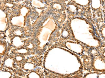 S100A12 Antibody