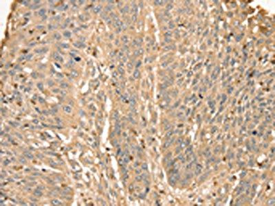S100A12 Antibody