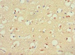 S100B Antibody