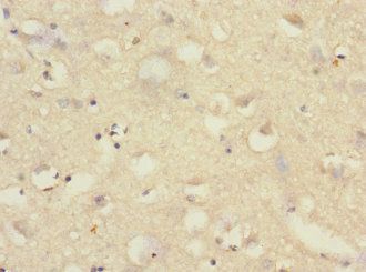 SAE1 Antibody