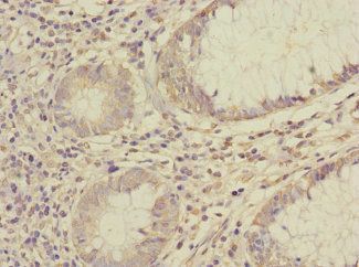 SAE1 Antibody