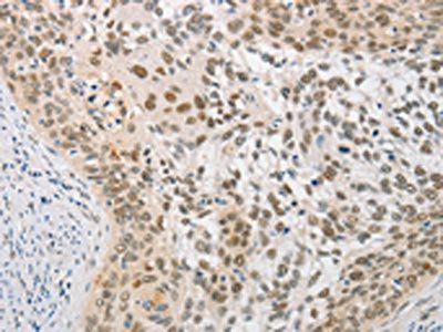 SAE1 Antibody