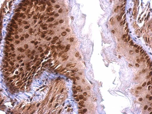SAFB Rabbit Polyclonal Antibody