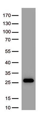 SARS-CoV-2 S Protein Mouse Monoclonal Antibody