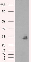 SARS-CoV-2 S Protein Mouse Monoclonal Antibody