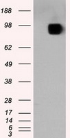 SARS-CoV-2 S Protein Mouse Monoclonal Antibody