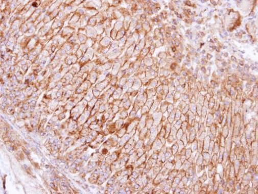 SCAMP3 Rabbit Polyclonal Antibody