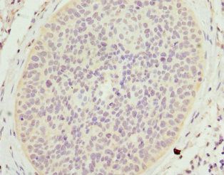 SCGB2A2 Antibody
