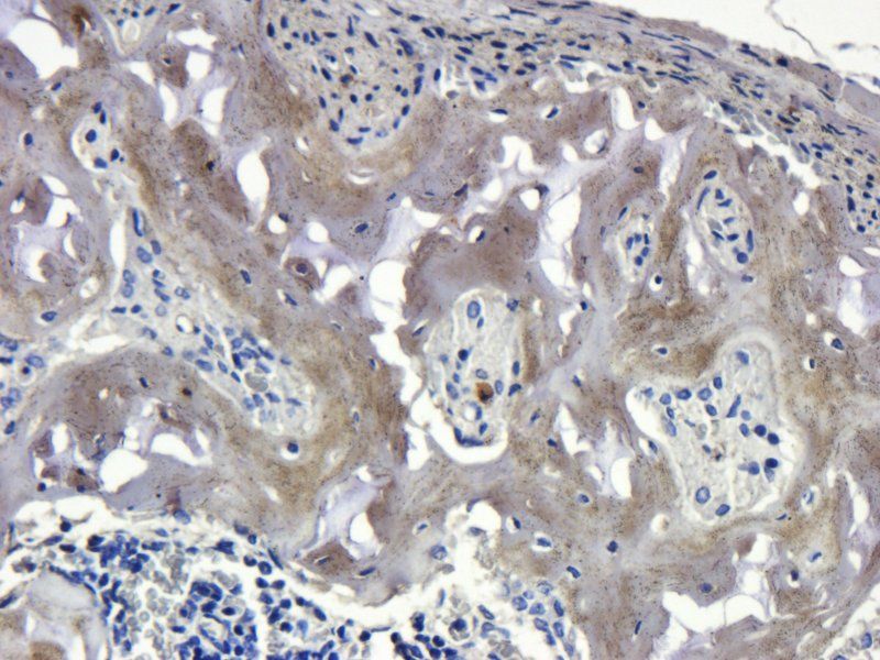 Sclerostin Rabbit Polyclonal Antibody