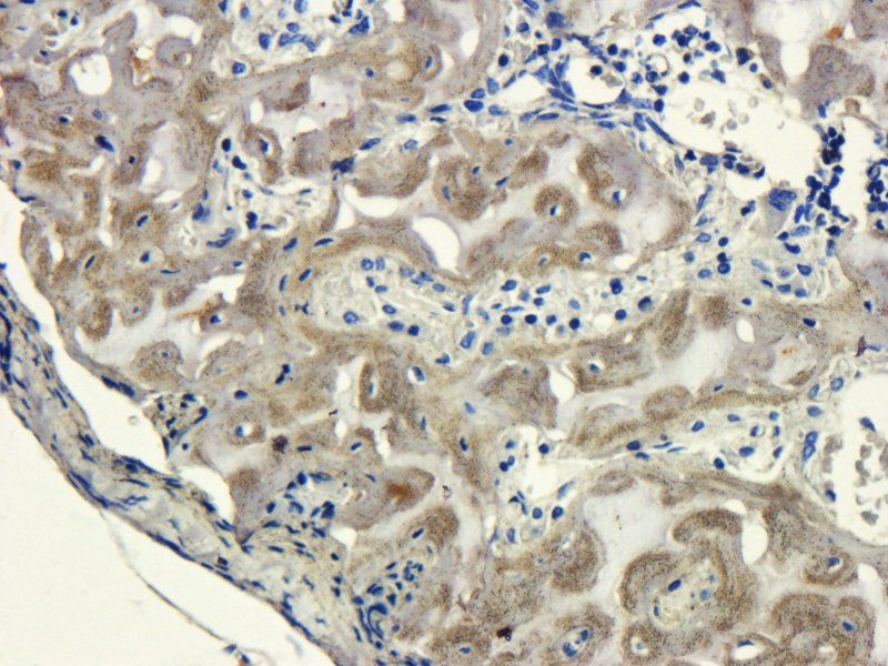 Sclerostin Rabbit Polyclonal Antibody