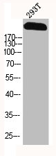 SCN9A Antibody