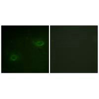 SDC4 Antibody