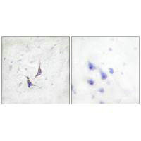 SDC4 Antibody
