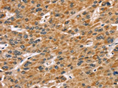 SDCBP Antibody