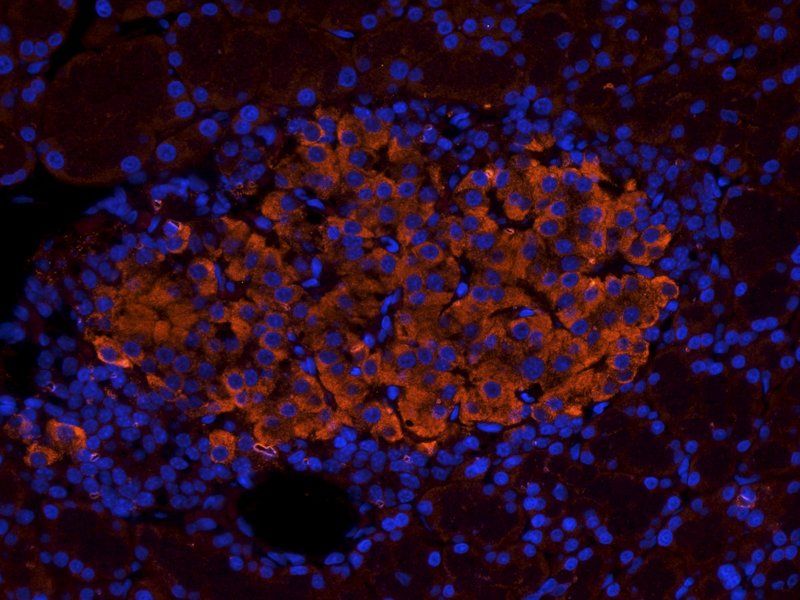 SDF1 Rabbit Polyclonal Antibody