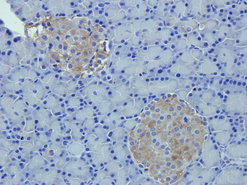 SDF1 Rabbit Polyclonal Antibody