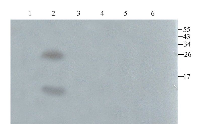 SDF1 Rabbit Polyclonal Antibody