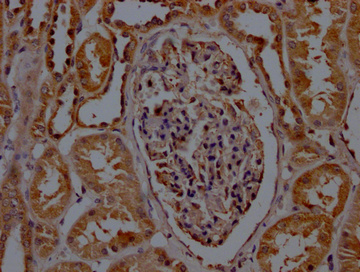 SDHB Antibody