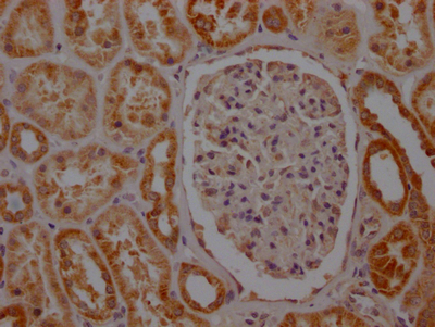 SDHB Antibody